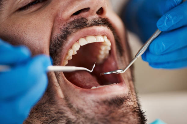Best Emergency Denture Repair in Palmer Ranch, FL