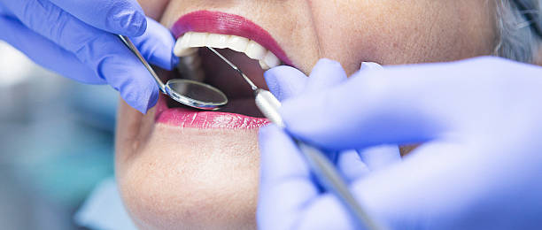 Best Emergency Treatment for Dental Infections or Abscesses in Palmer Ranch, FL